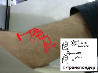 Alpha_TCV - Tau_mount.jpg