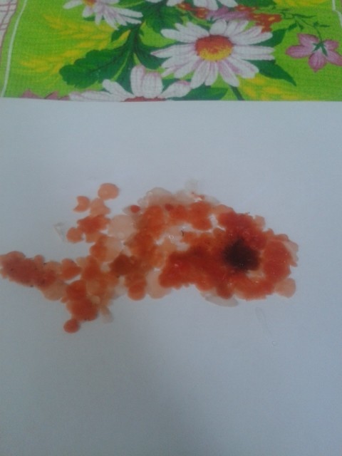 ОТЛИВКИ ВОСКОМ - image.jpg