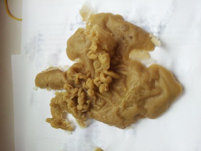 ОТЛИВКИ ВОСКОМ - 20150502_112119-1 (2).jpg