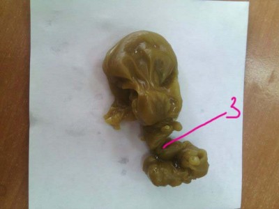 ОТЛИВКИ ВОСКОМ - 0334ff84a723.jpg