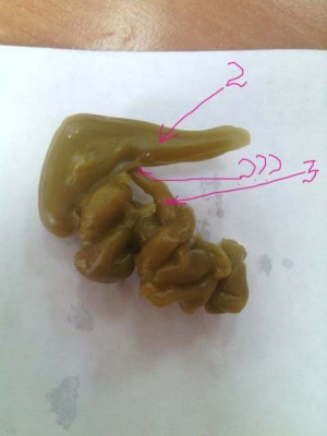 ОТЛИВКИ ВОСКОМ - 8f929e391012.jpg