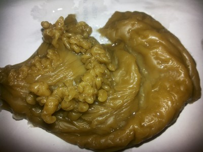 Первый день.  Сердце.