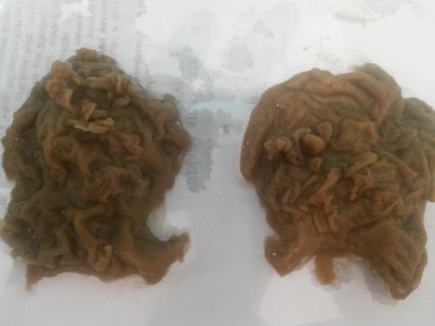 Третий день.  Голова