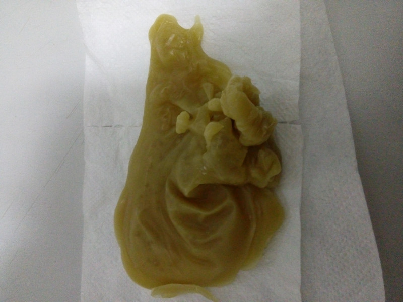 ОТЛИВКИ ВОСКОМ - 20161224_183842.jpg