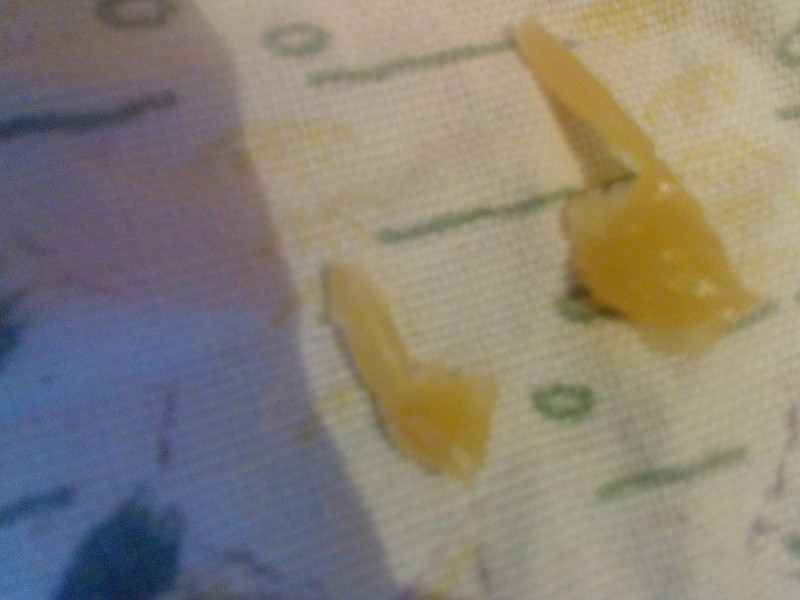 ОТЛИВКИ ВОСКОМ - IMG_20170327_161202.jpg