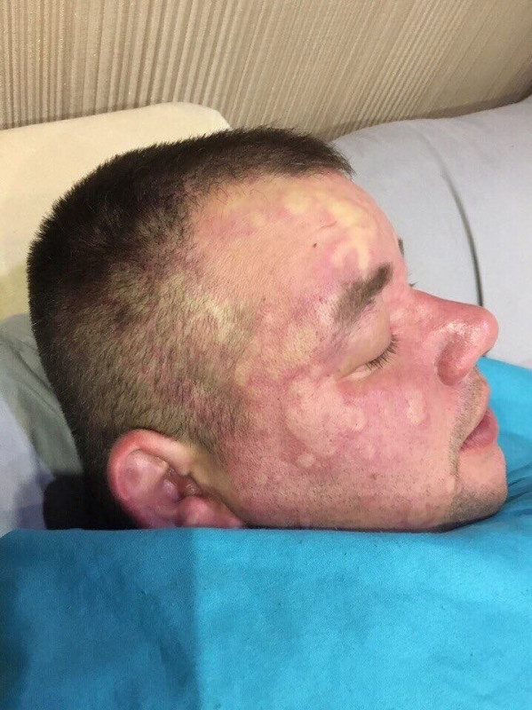 Очередной приступ
