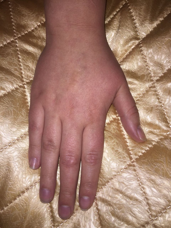 Вопросы по Хирологии писать здесь. Просмотр ладони. Тема для данных - IMG-20180321-WA0007.jpg