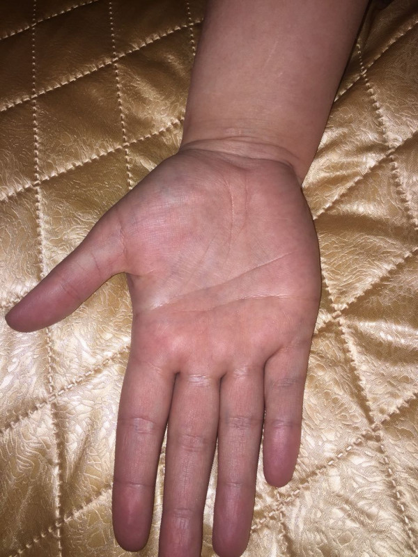 Вопросы по Хирологии писать здесь. Просмотр ладони. Тема для данных - IMG-20180321-WA0006.jpg