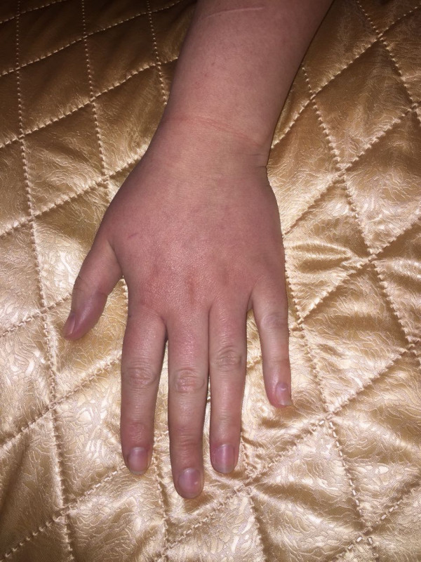 Вопросы по Хирологии писать здесь. Просмотр ладони. Тема для данных - IMG-20180321-WA0004.jpg