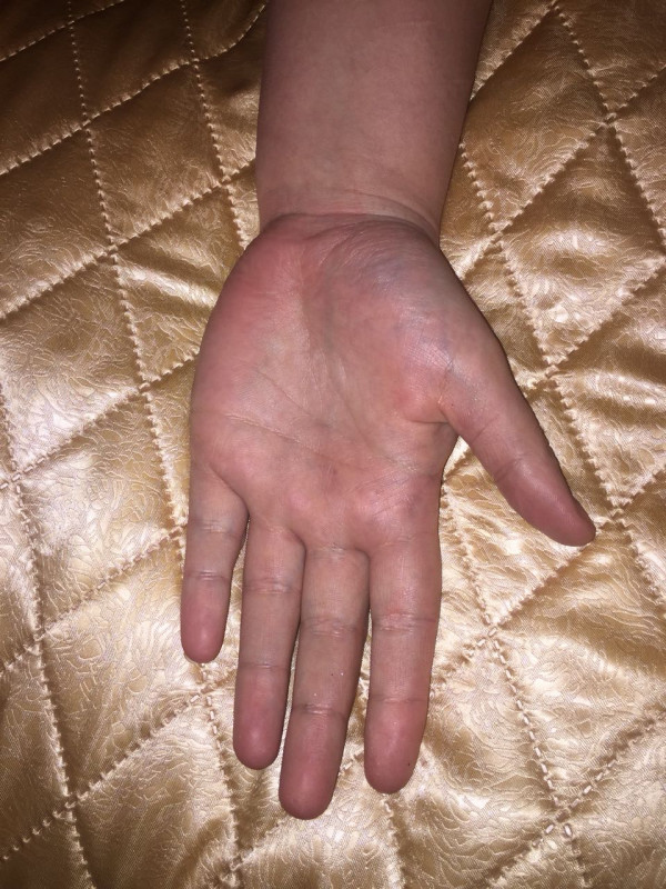 Вопросы по Хирологии писать здесь. Просмотр ладони. Тема для данных - IMG-20180321-WA0000.jpg