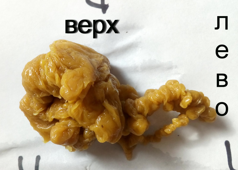 ОТЛИВКИ ВОСКОМ - IMG_20181003_143003.jpg